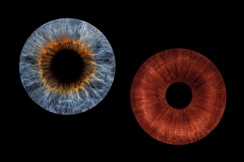 Iris-Fotografie-Unna - blaue und braune Iris vor schwarzem Hintergrund